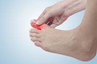 How to Identify Gout