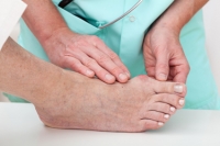 Causes and Treatment of Bunions